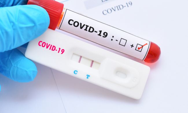 Planos de saúde agora são obrigados a cobrir testes sorológicos para detecção da Covid-19