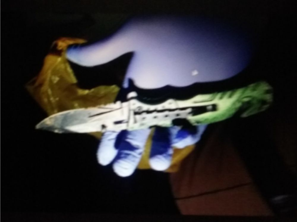 Após briga por uma mulher, jovem acaba ferido gravemente com canivete
