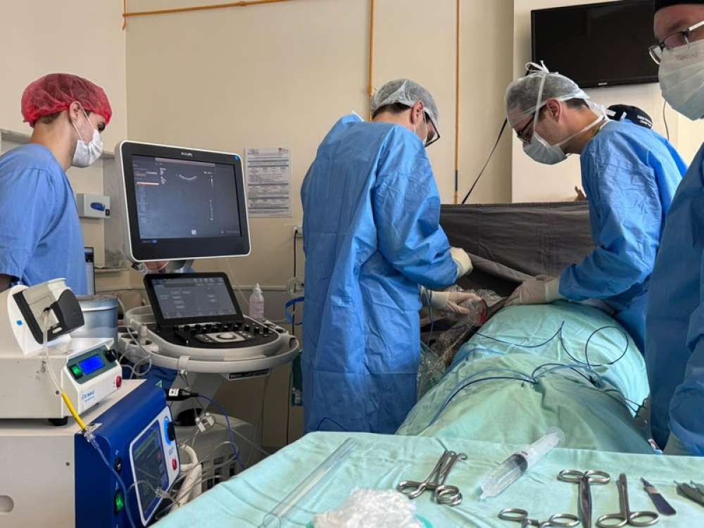 Hospital Santa Isabel realiza tratamento inédito pelo SUS para tumores hepáticos vinculados ao transplante de fígado