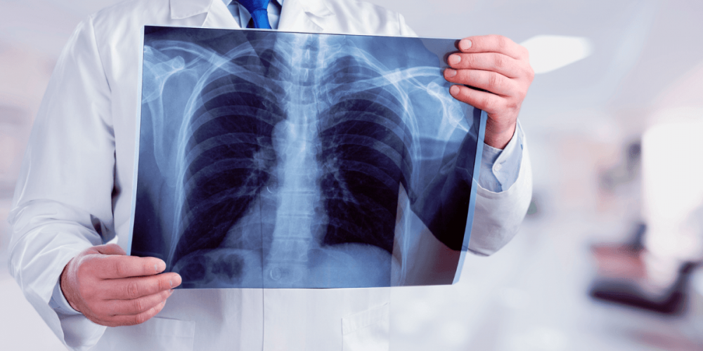 Automação ainda não chegou à experiência do paciente na radiologia, mostra pesquisa da Pixeon